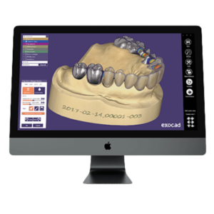 exocad DentalCAD